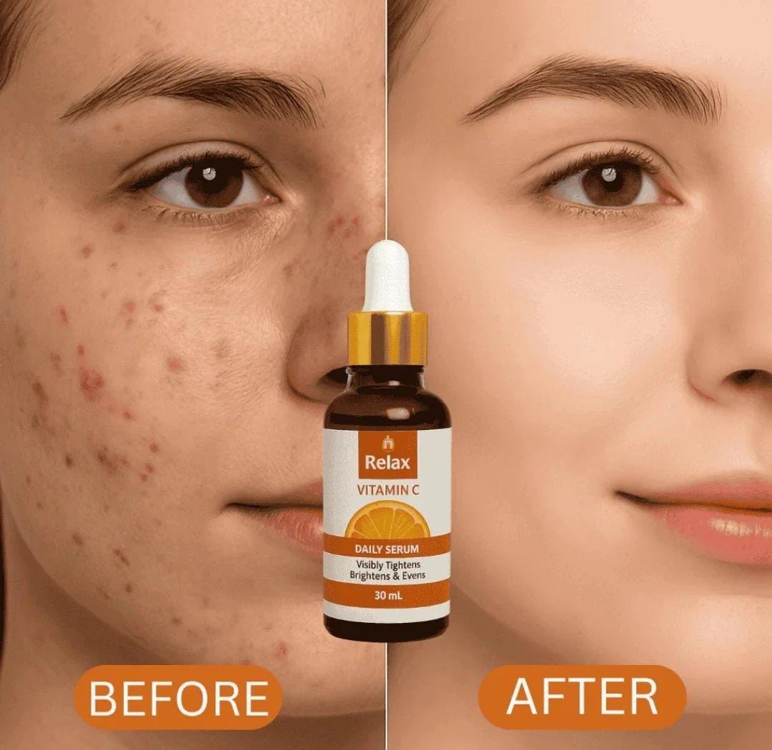 Relax Vitamin C Daily Serum - 30ml | Brightening & Anti-Aging Facial Serum - Image 4