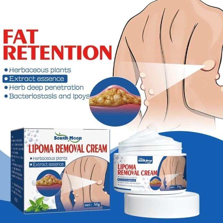 South Moon Lipoma Removal Cream (50g) | Natural Herbal Ointment for Body Lumps & Skin Knot Relief | Professional Skin Smoothing Formula - Image 5
