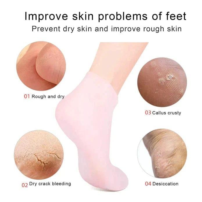 Premium Care Silicone Gel Socks for Dry Feet, Cracked Heels & Rough Skin – Reusable Foot Moisturizing Socks Pakistan - Image 2