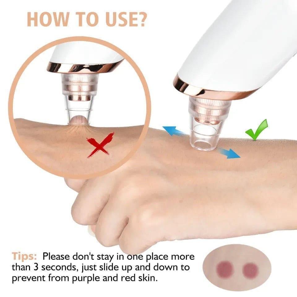 Travel Blackhead Remover for All Skin Types