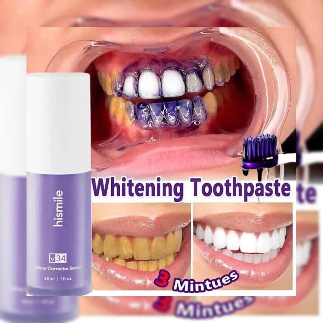 V34 Teeth Whitening Serum 50ml – Whitening Cream for a Brighter-Looking Smile - Image 5