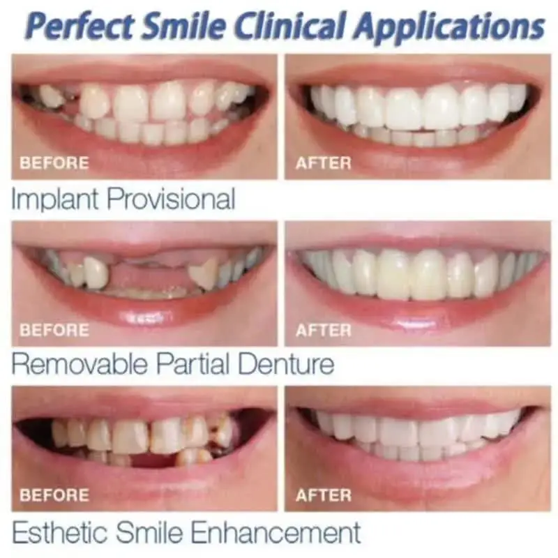Teeth Whitening Snap On Fake Teeth - Image 4