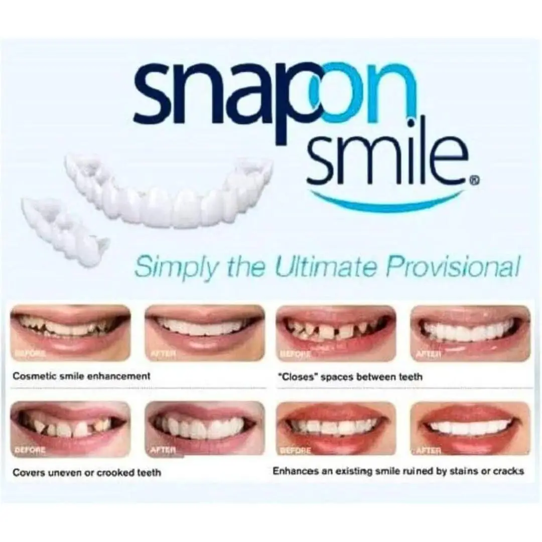 Teeth Whitening Snap On Fake Teeth - Image 2