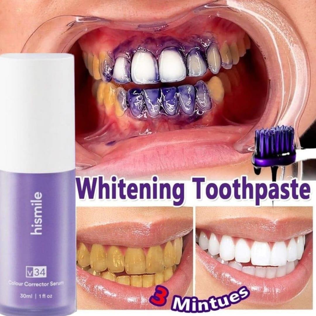 V34 Colour Corrector Serum 30ml – Teeth Whitening Serum for Brighter & More Attractive Smile - Image 2