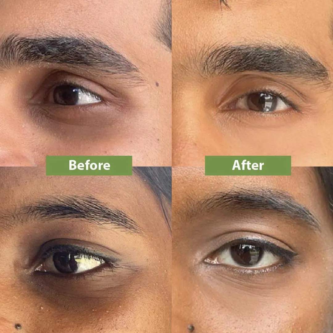 Ever Rosa Vitamin C Eye Cream 3-in-1 - Image 2