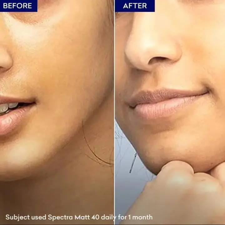 Spectra Matt SPF50+ Gel – Matte Sunscreen for Oily & Acne-Prone Skin - Image 2