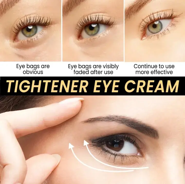 Dark Spots Removal Eye Serum for Brighter Eyes - Image 2