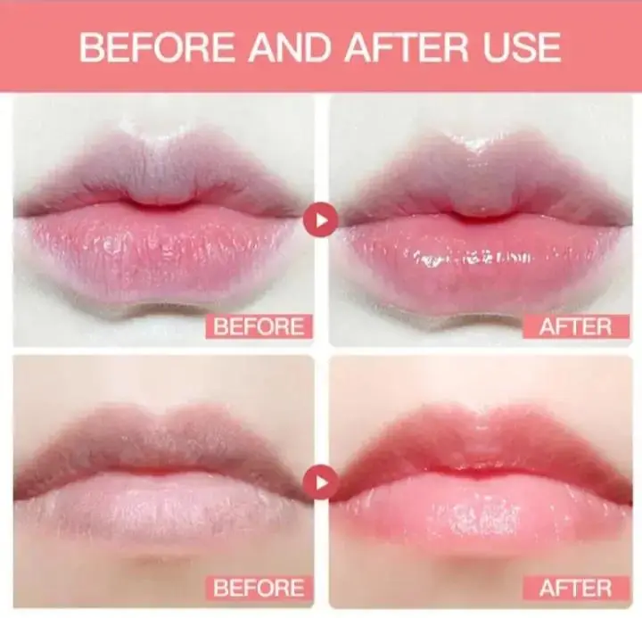 Moisturizing Lip Honey Balm 2 Pcs Pack - Image 6