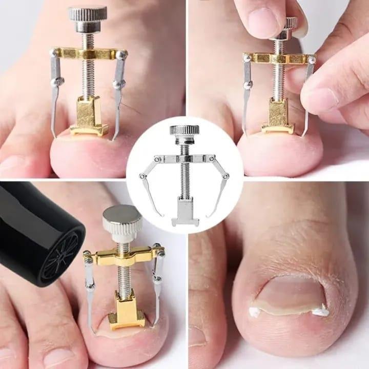 Steel Toenail Tool – Silver & Golden Travel Hygiene Kit - Image 3