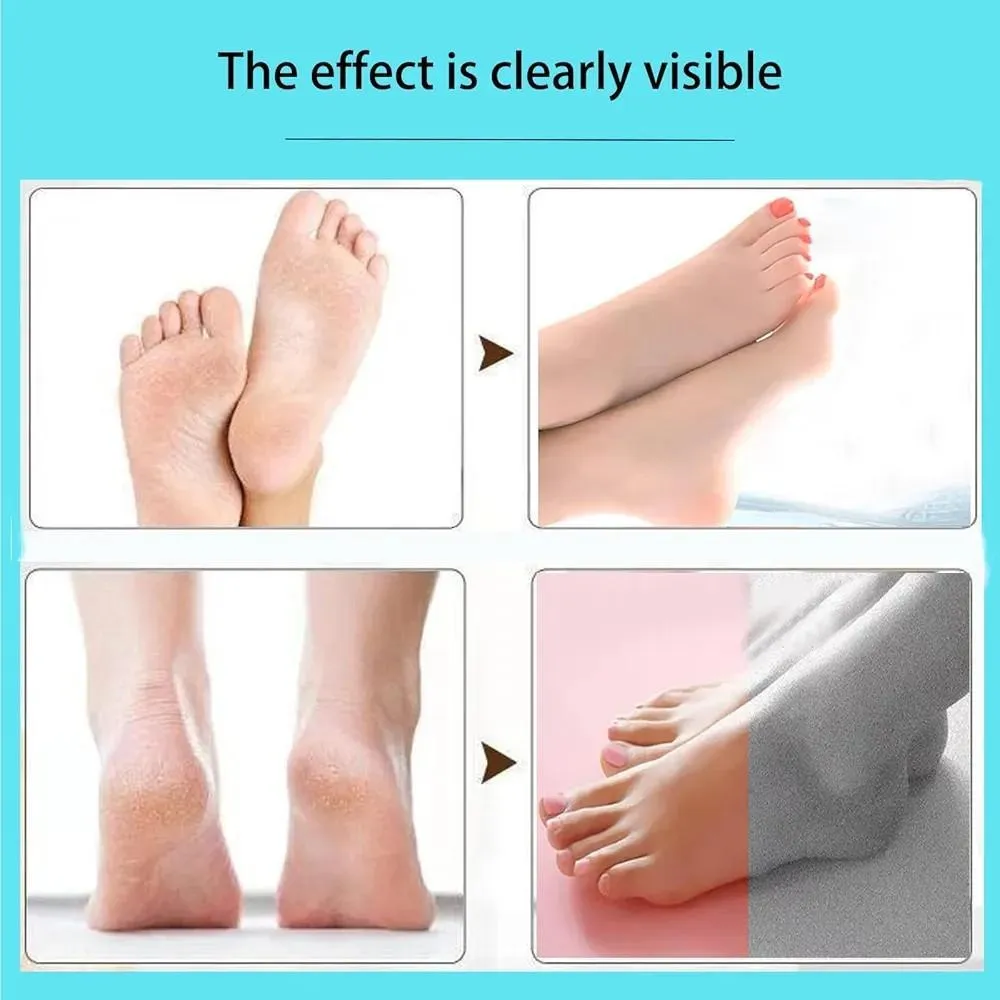 Electric Foot Exfoliating Scrubber for Smooth, Soft Feet - Image 6