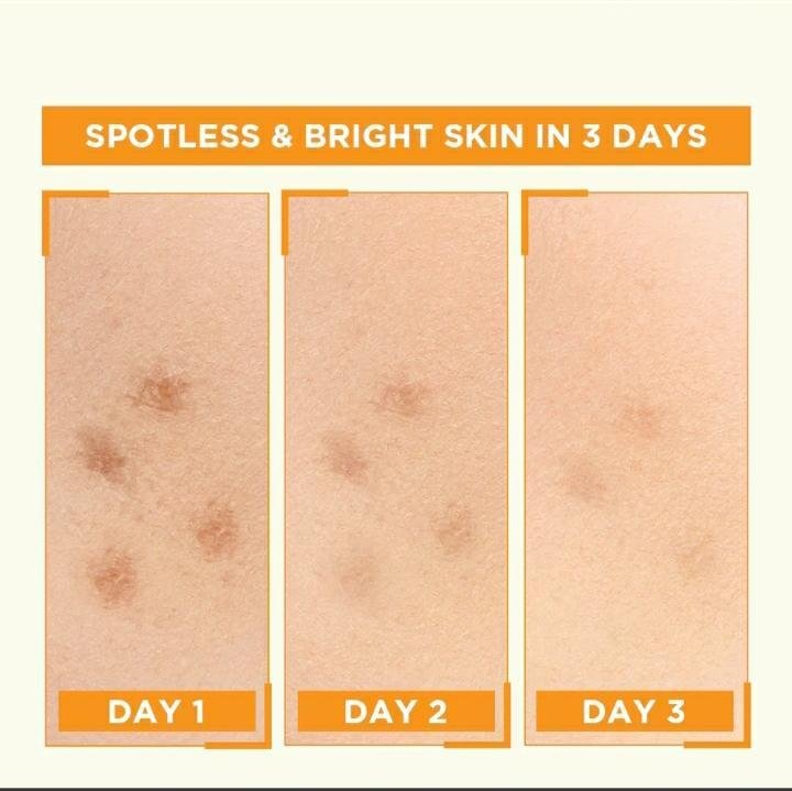 Garnier Vitamin C Serum 30ml – Brightening Spot Lightener Face Serum for Dark Spots & Radiant-Looking Skin - Image 4