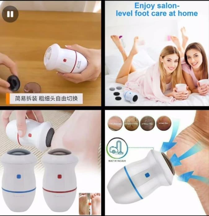 Cordless Electric Foot Grinder – White & Blue ABS Body - Image 4