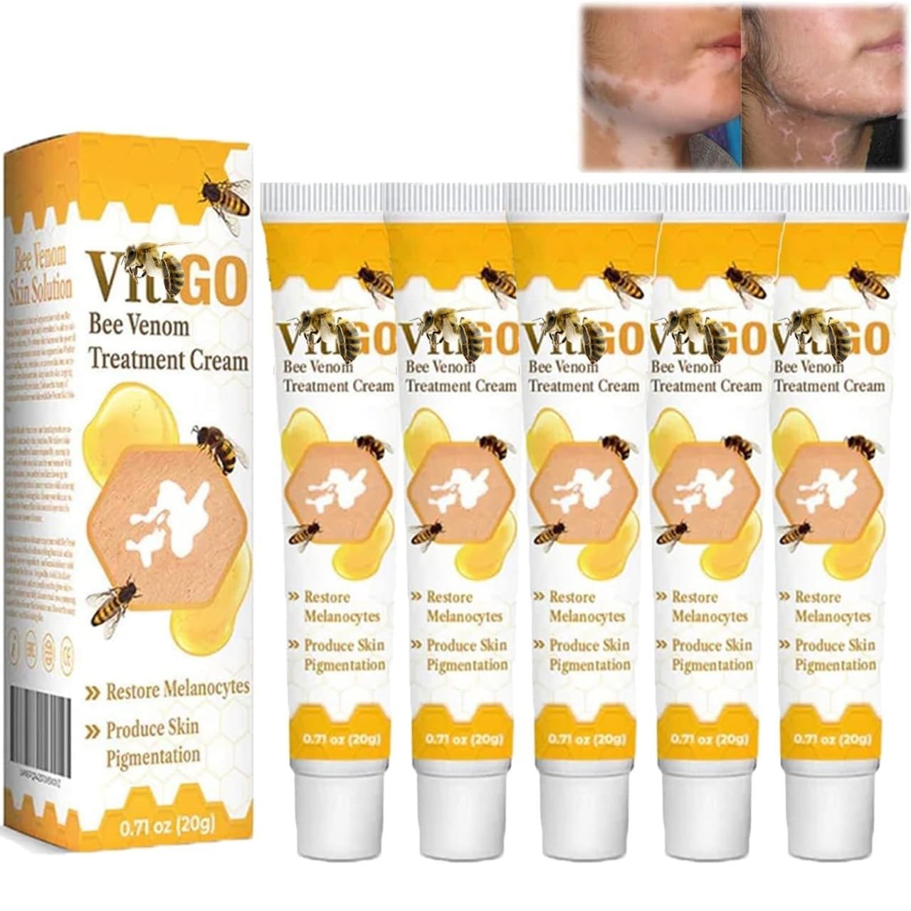 Fivfivgo™ VitiGO Bee Venom Correcting Cream (20g) Support for Skin Pigmentation Recovery and Even Skin Tone - Image 2